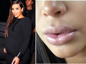 Los labios de Kim Kardashian están fuera de control