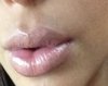 Los labios carnosos de Kim Kardashian