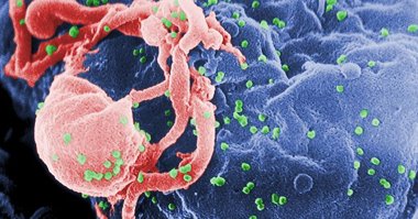 Foto: Utilizan el VIH para curar a 6 niños con enfermedades hereditarias (WIKIMEDIA COMMONS)