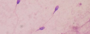 Foto: La ingesta de ácidos grasos Omega 3 permite recuperar la calidad del semen (BOBJGALINDO/WIKIMEDIA COMMONS)