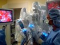 Google y Johnson & Johnson trabajan en un robot cirujano